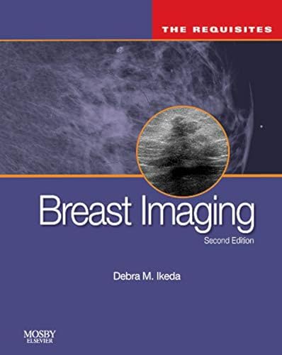9780323051989: Breast Imaging: The Requisites (Requisites in Radiology)