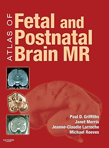 Beispielbild fr Atlas of Fetal and Postnatal Brain MR zum Verkauf von Mispah books