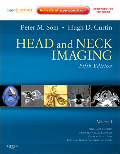 9780323053556: Head and Neck Imaging: Expert Consult- Online and Print