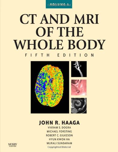 Stock image for CT and MRI of the Whole Body, 2-Volume Set, 5e (Computed Tomography and Magnetic Resonance Imaging of the Wh) for sale by dsmbooks
