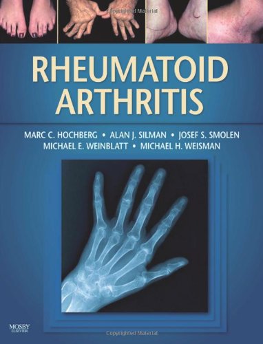 Imagen de archivo de Rheumatoid Arthritis a la venta por Better World Books