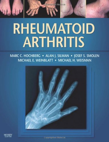 9780323054751: Rheumatoid Arthritis: A Companion to Rheumatology