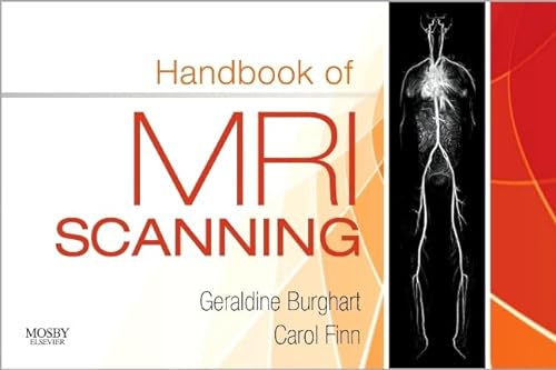 9780323068185: Handbook of MRI Scanning