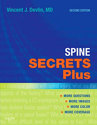 9780323069526: Spine Secrets Plus, 2e