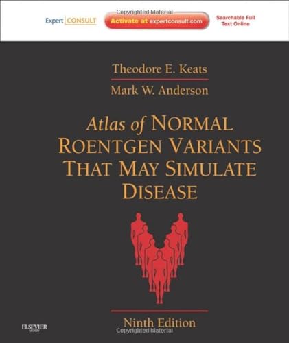 Stock image for Atlas of Normal Roentgen Variants That May Simulate Disease for sale by GF Books, Inc.