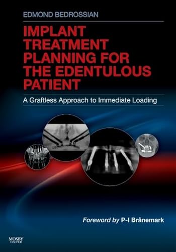 Implant Treatment Planning for the Edentulous Patient: A Graftless Approach to Immediate Loading - Bedrossian, Edmond