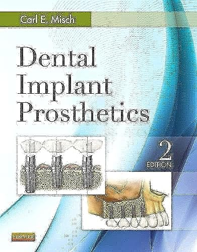 Imagen de archivo de Dental Implant Prosthetics a la venta por Brook Bookstore