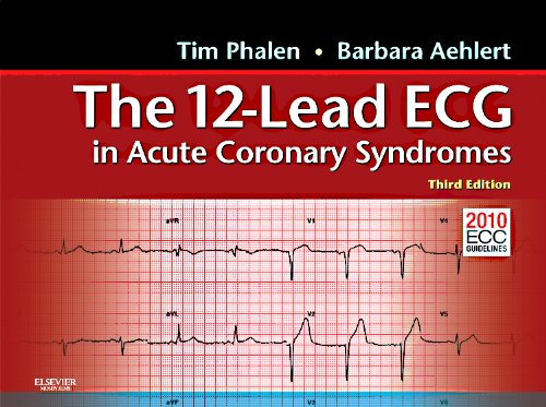 Stock image for The 12-Lead ECG in Acute Coronary Syndromes : Pocket Reference for the 12-Lead ECG in Acute Coronary Syndromes for sale by Better World Books