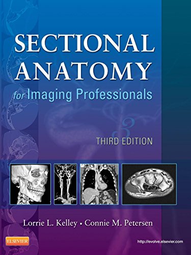 9780323082600: Sectional Anatomy for Imaging Professionals, 3e