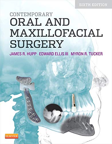 9780323091770: Contemporary Oral and Maxillofacial Surgery