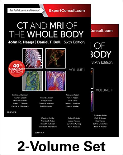 9780323113281: CT and MRI of the Whole Body, 2-Volume Set