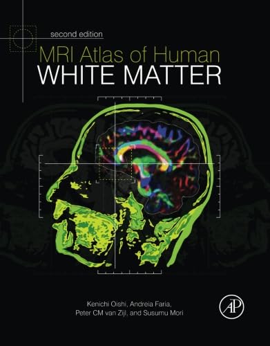 Stock image for MRI Atlas of Human White Matter for sale by Revaluation Books