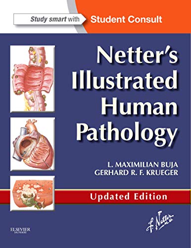 9780323220897: Netter's Illustrated Human Pathology Updated Edition: with Student Consult Access