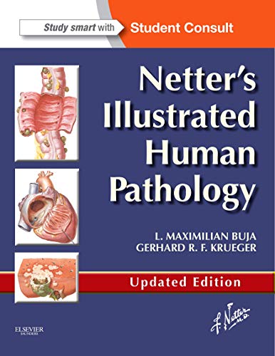 9780323220897: Netter's Illustrated Human Pathology Updated Edition, with Student Consult Access
