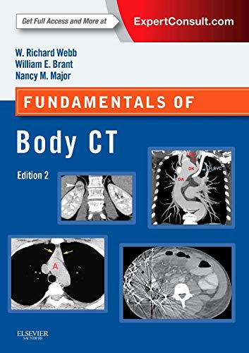 Stock image for Fundamentals of Body CT (Fundamentals of Radiology) for sale by HPB-Red
