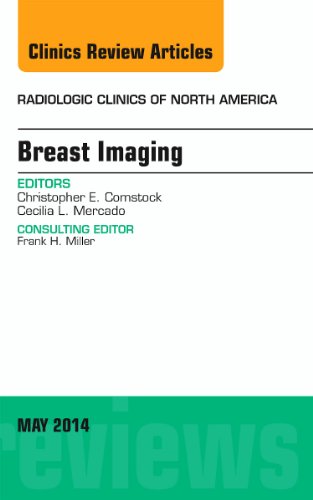 9780323261265: Breast Imaging, An Issue of Radiologic Clinics of North America (Volume 52-3) (The Clinics: Radiology, Volume 52-3)