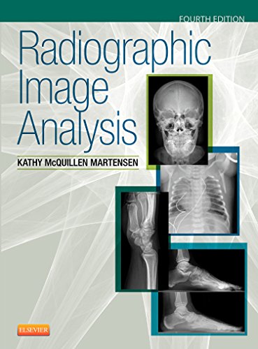 9780323280525: Radiographic Image Analysis