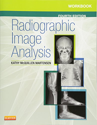 Stock image for Workbook for Radiographic Image Analysis for sale by ThriftBooks-Dallas