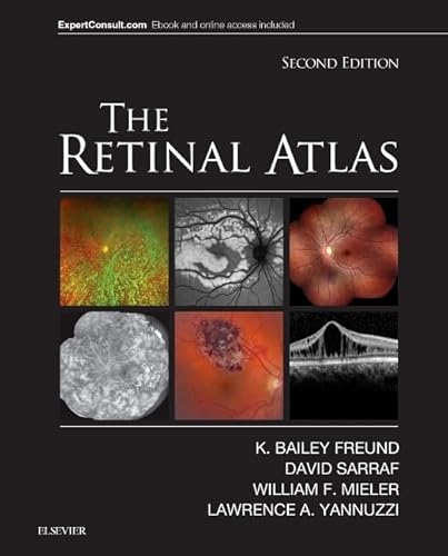 Beispielbild fr The Retinal Atlas - Expert Consult - Online and Print zum Verkauf von Jasmin Berger