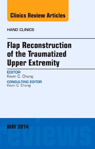 Imagen de archivo de Flap Reconstruction of the Traumatized Upper Extremity, an Issue of Hand Clinics: Volume 30-2 a la venta por ThriftBooks-Dallas