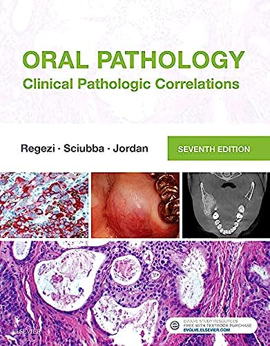 9780323297684: Oral Pathology
