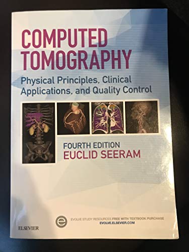 9780323312882: Computed Tomography: Physical Principles, Clinical Applications, and Quality Control