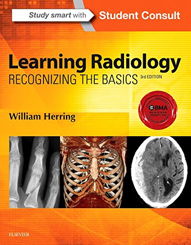 9780323328074: Learning Radiology: Recognizing the Basics [Lingua inglese]