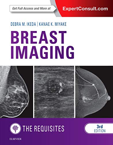 Imagen de archivo de Breast Imaging: The Requisites (Requisites in Radiology) a la venta por HPB-Red