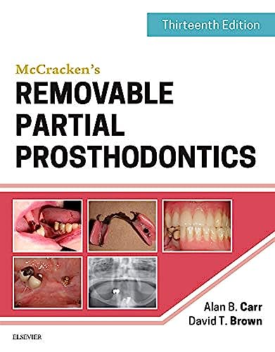 9780323339902: McCracken's Removable Partial Prosthodontics