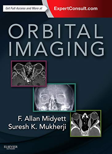 Stock image for Orbital Imaging for sale by Mispah books