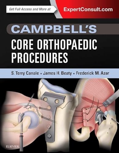 9780323357630: Campbell's Core Orthopaedic Procedures