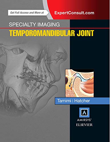 9780323377041: Temporomandibular Joint