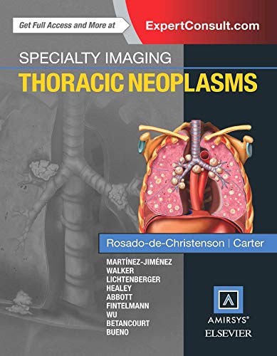 9780323377065: Specialty Imaging: Thoracic Neoplasms