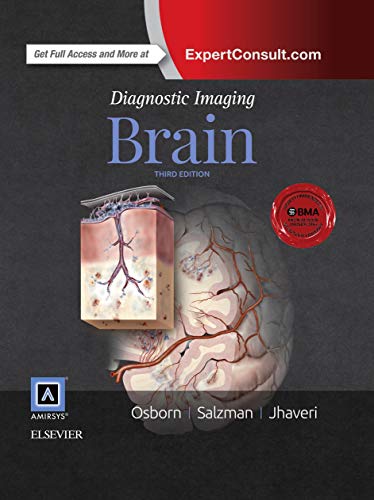 Beispielbild fr Diagnostic Imaging: Brain zum Verkauf von HPB-Red