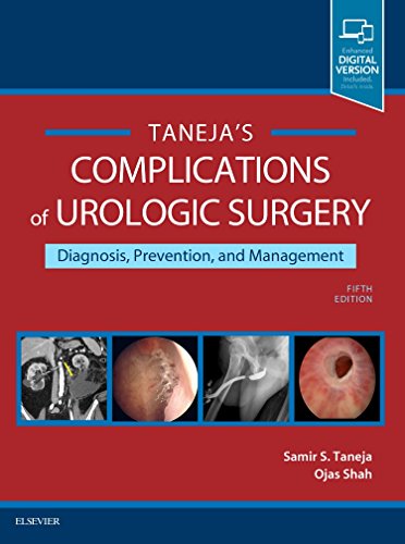Beispielbild fr Complications of Urologic Surgery: Prevention and Management zum Verkauf von Books Unplugged