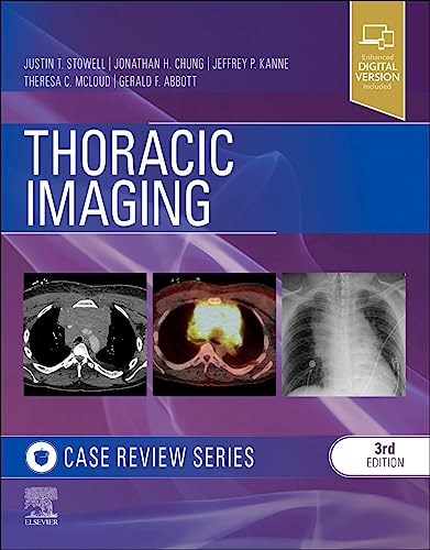 Beispielbild fr Thoracic Imaging: Case Review zum Verkauf von Open Books