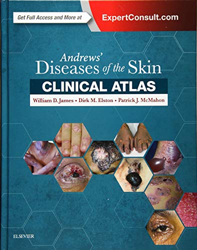 Stock image for Andrews Diseases of the Skin Clinical Atlas for sale by Opalick