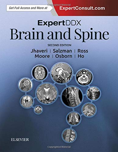 9780323443081: ExpertDDX: Brain and Spine