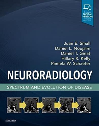 Beispielbild fr Neuroradiology: Spectrum and Evolution of Disease zum Verkauf von Big River Books