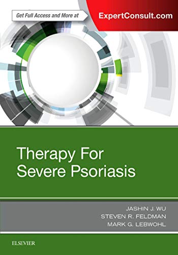 Imagen de archivo de Therapy for Severe Psoriasis, 1e a la venta por Chiron Media