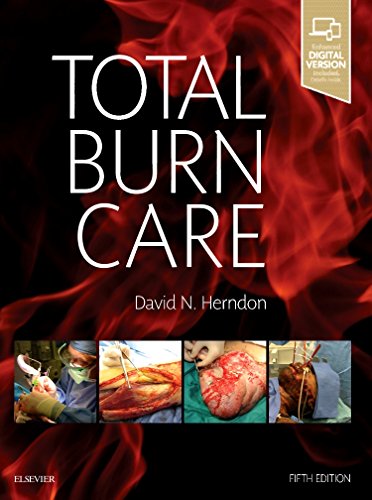 9780323476614: Total Burn Care: Expert Consult - Online and Print