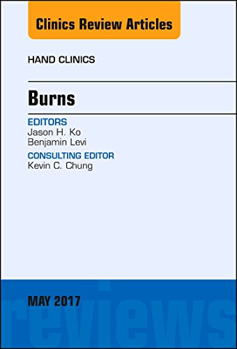 Imagen de archivo de Burns, An Issue of Hand Clinics (Volume 33-2) (The Clinics: Orthopedics, Volume 33-2) a la venta por Patrico Books