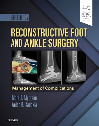 Beispielbild fr Reconstructive Foot and Ankle Surgery: Management of Complications: Expert Consult - Online, Print, and DVD zum Verkauf von Byrd Books