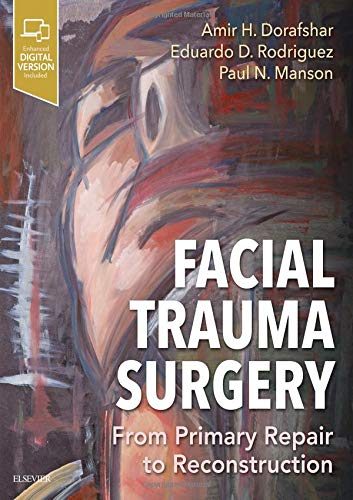 Stock image for Facial Trauma Surgery: From Primary Repair to Reconstruction for sale by ZBK Books