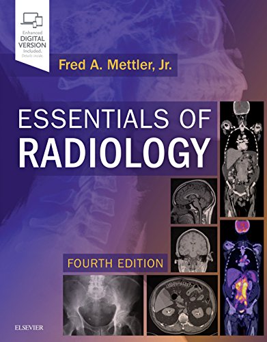 Stock image for Essentials of Radiology: Common Indications and Interpretation for sale by BooksRun