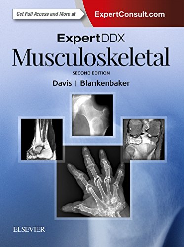 Stock image for ExpertDDx: Musculoskeletal for sale by HPB-Red