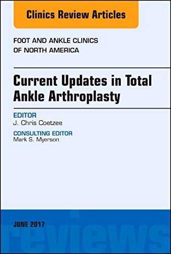 Imagen de archivo de Current Updates in Total Ankle Arthroplasty, An Issue of Foot and Ankle Clinics of North America, 1e: Volume 22-2 (The Clinics: Orthopedics) a la venta por Chiron Media