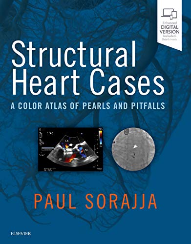 9780323546959: Structural Heart Cases: A Color Atlas of Pearls and Pitfalls