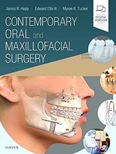 Stock image for Contemporary Oral and Maxillofacial Surgery for sale by Romtrade Corp.