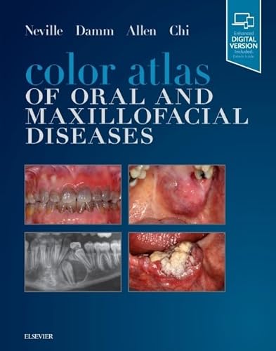 Imagen de archivo de Color Atlas of Oral and Maxillofacial Diseases a la venta por Brook Bookstore